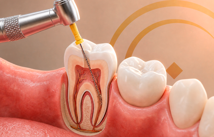 Endodontia