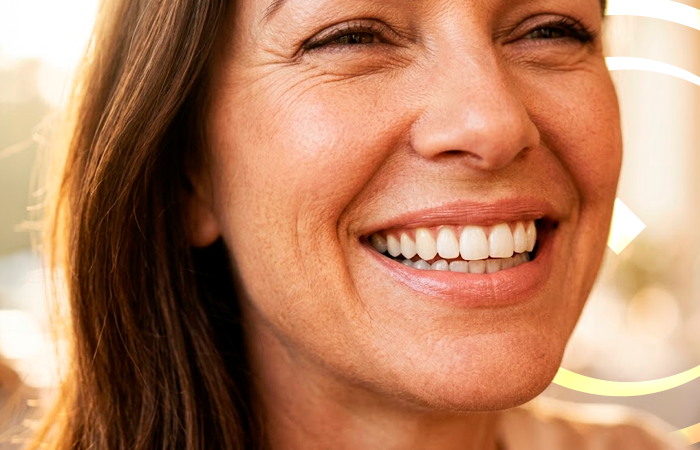 Implantes Dentários