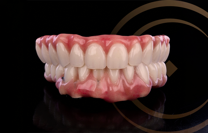 Prótese Dentária